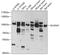 Neuroligin 4 Y-Linked antibody, A11178, Boster Biological Technology, Western Blot image 