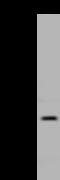 Deoxythymidylate Kinase antibody, 204470-T44, Sino Biological, Western Blot image 