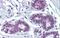 MYC Associated Zinc Finger Protein antibody, PA5-41434, Invitrogen Antibodies, Immunohistochemistry paraffin image 