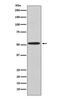 Potassium Voltage-Gated Channel Subfamily J Member 2 antibody, M01850, Boster Biological Technology, Western Blot image 