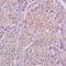 EPH Receptor B4 antibody, orb101282, Biorbyt, Immunohistochemistry paraffin image 