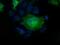 Profilin 1 antibody, GTX83902, GeneTex, Immunofluorescence image 