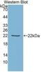 TIMP Metallopeptidase Inhibitor 1 antibody, abx131865, Abbexa, Western Blot image 