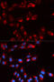 Complement Factor Properdin antibody, STJ27351, St John