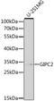 GIPC PDZ Domain Containing Family Member 2 antibody, MBS126909, MyBioSource, Western Blot image 