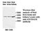 Adenosine A2b Receptor antibody, MBS416092, MyBioSource, Western Blot image 