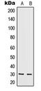 TRF antibody, LS-C352360, Lifespan Biosciences, Western Blot image 