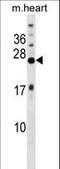 Potassium Voltage-Gated Channel Interacting Protein 4 antibody, LS-C165426, Lifespan Biosciences, Western Blot image 