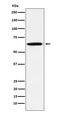 Growth Factor Receptor Bound Protein 7 antibody, M02528-1, Boster Biological Technology, Western Blot image 