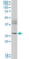 Intraflagellar Transport 57 antibody, LS-C139226, Lifespan Biosciences, Western Blot image 