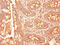 Transforming Growth Factor Beta Receptor 1 antibody, CSB-PA023451LA01HU, Cusabio, Immunohistochemistry frozen image 