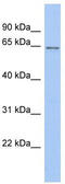 SWI/SNF Related, Matrix Associated, Actin Dependent Regulator Of Chromatin, Subfamily D, Member 2 antibody, TA334106, Origene, Western Blot image 