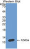 Natriuretic Peptide A antibody, LS-C372504, Lifespan Biosciences, Western Blot image 