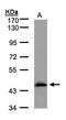 Medium-chain specific acyl-CoA dehydrogenase, mitochondrial antibody, GTX100488, GeneTex, Western Blot image 