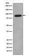 Aryl Hydrocarbon Receptor Nuclear Translocator antibody, M02263, Boster Biological Technology, Western Blot image 