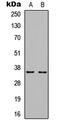 Cyclin D1 antibody, GTX54957, GeneTex, Western Blot image 
