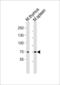 IL2 Inducible T Cell Kinase antibody, PA5-49363, Invitrogen Antibodies, Western Blot image 