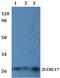 Nucleolar Protein With MIF4G Domain 1 antibody, PA5-75894, Invitrogen Antibodies, Western Blot image 