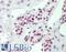 MAPK Activated Protein Kinase 5 antibody, LS-B9569, Lifespan Biosciences, Immunohistochemistry frozen image 