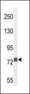 Choline O-Acetyltransferase antibody, LS-B10552, Lifespan Biosciences, Western Blot image 