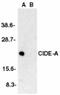 Cell Death Inducing DFFA Like Effector A antibody, PA1-30714, Invitrogen Antibodies, Western Blot image 