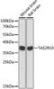 Taste 2 Receptor Member 10 antibody, GTX66341, GeneTex, Western Blot image 