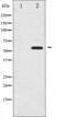 Mitogen-Activated Protein Kinase Kinase Kinase 8 antibody, abx012223, Abbexa, Western Blot image 