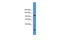 Chloride Voltage-Gated Channel 1 antibody, ARP34912_P050, Aviva Systems Biology, Western Blot image 