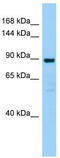 Sphingomyelin Phosphodiesterase 4 antibody, TA342050, Origene, Western Blot image 