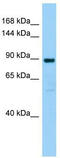 Sphingomyelin phosphodiesterase 4 antibody, TA342050, Origene, Western Blot image 