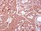 Inhibitor Of Nuclear Factor Kappa B Kinase Subunit Beta antibody, GTX107970, GeneTex, Immunohistochemistry paraffin image 