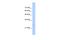 Transmembrane Protein 69 antibody, A17788, Boster Biological Technology, Western Blot image 