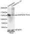 Mitogen-Activated Protein Kinase Kinase Kinase 5 antibody, STJ22251, St John