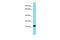 Fructosamine 3 Kinase antibody, PA5-70339, Invitrogen Antibodies, Western Blot image 