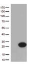 Cytoglobin antibody, TA812910, Origene, Western Blot image 