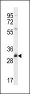 CTD Nuclear Envelope Phosphatase 1 antibody, MBS9208746, MyBioSource, Western Blot image 