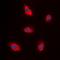 EPS8 Like 1 antibody, orb382538, Biorbyt, Immunofluorescence image 