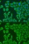 ATP Binding Cassette Subfamily F Member 2 antibody, GTX32985, GeneTex, Immunocytochemistry image 