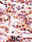 Pantothenate kinase 1 antibody, abx033205, Abbexa, Western Blot image 