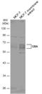 Glucosylceramidase Beta antibody, NBP1-32271, Novus Biologicals, Western Blot image 