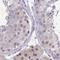 Retinoblastoma-like protein 1 antibody, NBP2-33791, Novus Biologicals, Immunohistochemistry paraffin image 