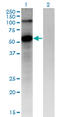 Frizzled Class Receptor 4 antibody, LS-C198548, Lifespan Biosciences, Western Blot image 