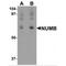 NUMB Endocytic Adaptor Protein antibody, MBS150158, MyBioSource, Western Blot image 