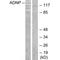 Activity Dependent Neuroprotector Homeobox antibody, A01855, Boster Biological Technology, Western Blot image 