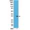 Aurora Kinase B antibody, M00762-4, Boster Biological Technology, Western Blot image 