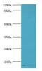 Calmodulin-like protein 5 antibody, LS-B15169, Lifespan Biosciences, Western Blot image 