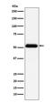 Acid Phosphatase, Prostate antibody, M02082-2, Boster Biological Technology, Western Blot image 