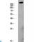 Platelet Derived Growth Factor Receptor Alpha antibody, LS-C814183, Lifespan Biosciences, Western Blot image 