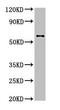 Dihydropyrimidinase-related protein 2 antibody, CSB-PA614975YA01HU, Cusabio, Western Blot image 