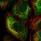 Keratin 15 antibody, NBP1-85602, Novus Biologicals, Immunocytochemistry image 